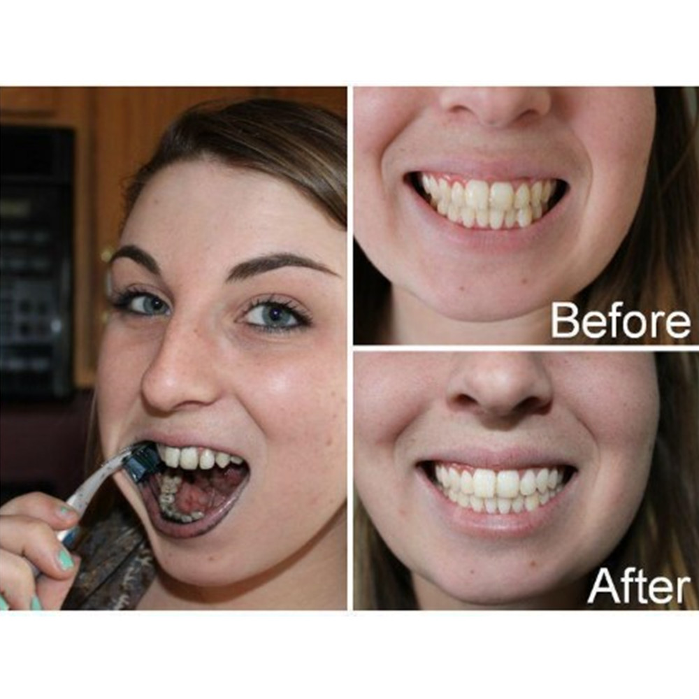 Dentes de carvão vegetal de ba - Teeth Whitening Co avaliação e preço