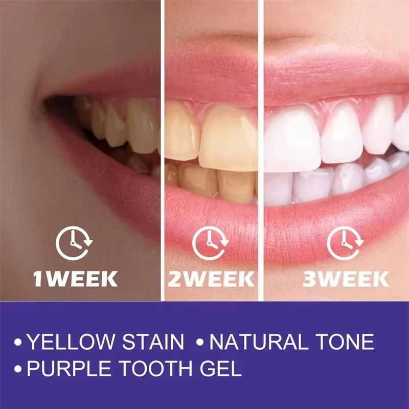 Limpeza dos dentes branqueamen - Teeth Whitening In Korea avaliação e preço