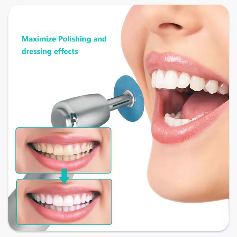 40 pçs discos de polimento den - Teeth Whitening Professional avaliação e preço
