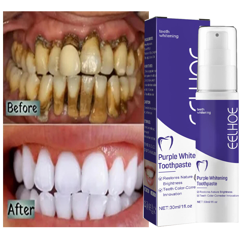 Creme dental clareador para li - Teeth Whitening In Korea avaliação e preço